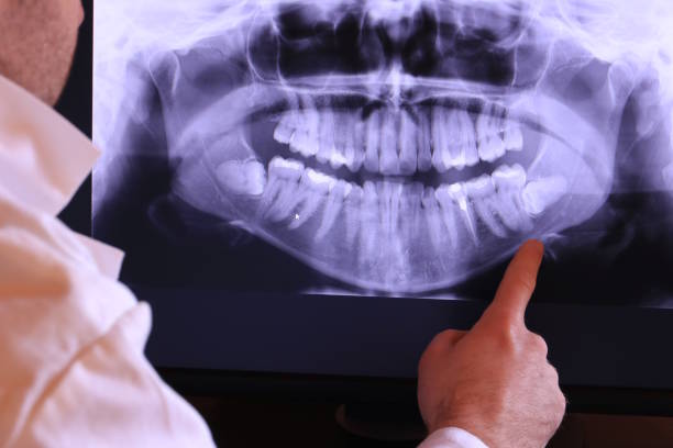 Best Emergency Denture Repair in Dubuque, IA